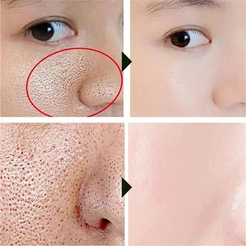 Salicylic Acid Pore Shrinking  - Skincare Salicylic Acid review and price
